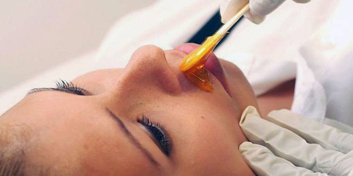 Shugaring du visage