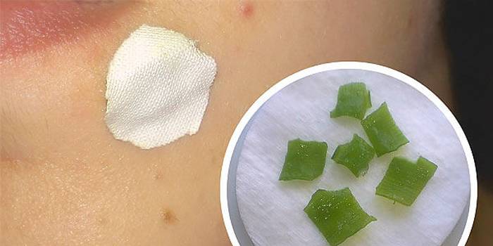 Compressa de folhas de aloe