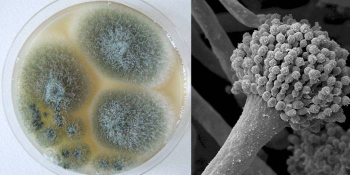 Aspergillus fumigatus