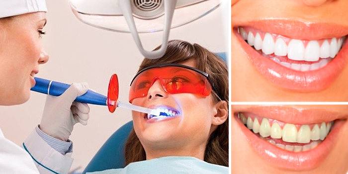 Kết quả làm trắng da bằng laser