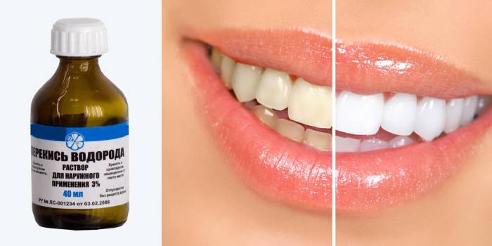 Kết quả của việc sử dụng hydro peroxide