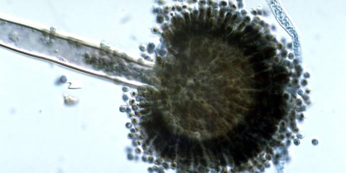 Aspergillus ไนเจอร์