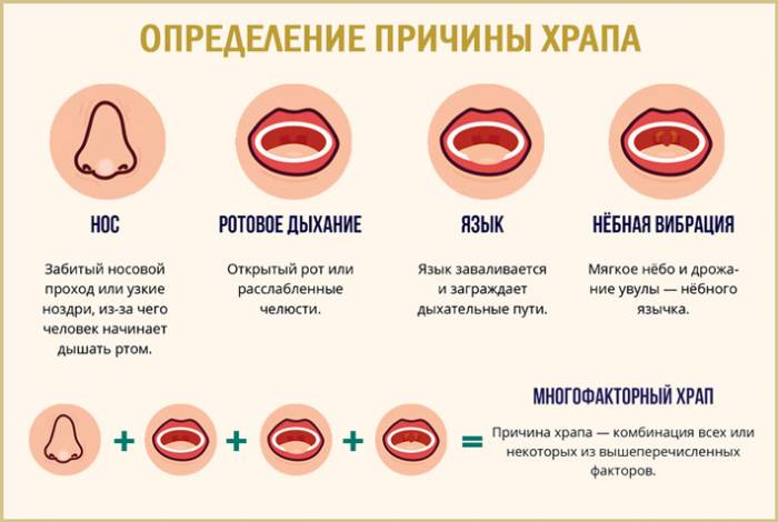 Определяне на причината за хъркането