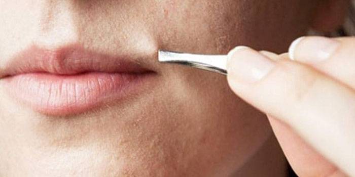 Épilation des poils du visage
