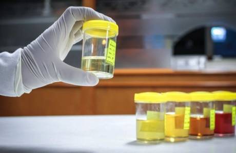 Streptococco nelle urine