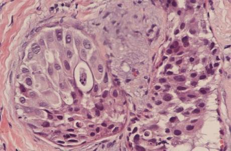 Mikä on histologia