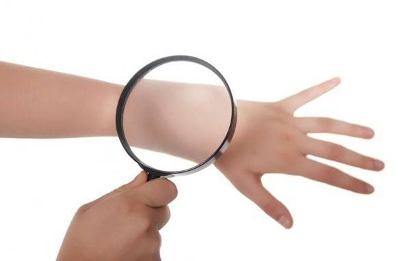 Traitement du psoriasis