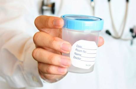 כיצד לעבור spermogram