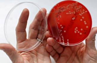 Streptococcus viridans