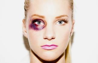 So entfernen Sie einen blauen Fleck an einem Tag unter dem Auge im Gesicht