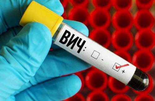 Kuo skiriasi ŽIV nuo AIDS?