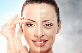 Retinoic Peeling