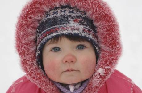 Allergie au froid