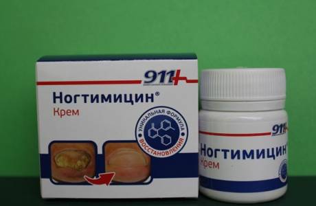 Nogtimisin 911