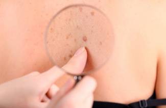 Pourquoi les taupes apparaissent