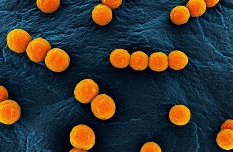 Staphylococcus aureus