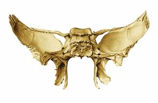 Xương sphenoid