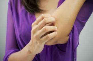 Remedio eficaz para la psoriasis