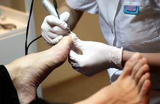 Pédicure médicale pour mycose des ongles