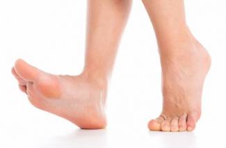 Pieds plats chez les adultes