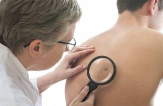 Cos'è il fibroma e come trattarlo