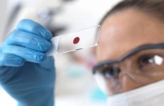 ¿Qué es hCG?