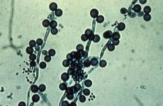 Candida Albicans