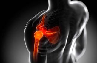 Traitement de la dislocation de la clavicule