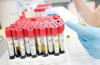 Qu'est-ce que l'estradiol