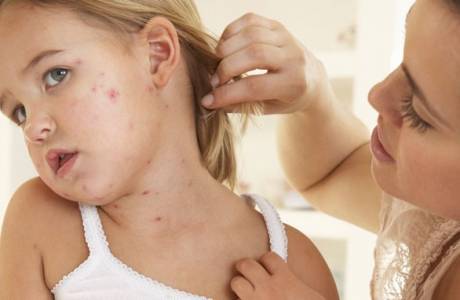 Netipinis dermatitas