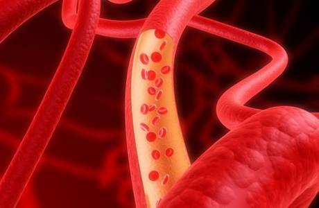 Ce înseamnă dacă hematocritul este crescut