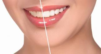 Comment blanchir les dents à la maison