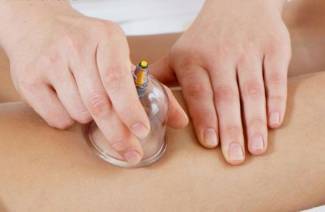 Kas yra hijama