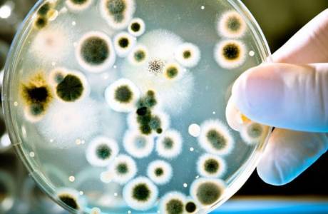 Mycoplasma hominis