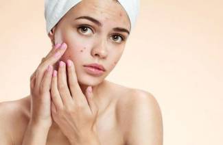 Acné sur le visage