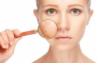 Veines d'araignée sur le visage