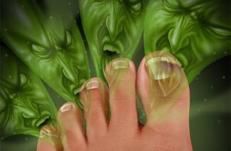 Comment traiter les champignons des ongles