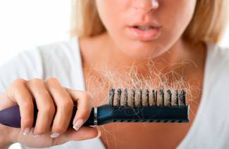 Pérdida difusa del cabello.