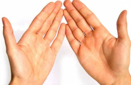 โรคสะเก็ดเงินที่มือ