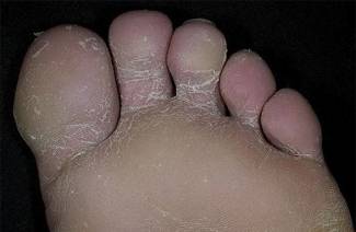 Champignon sur le pied