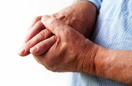 Behandlung von Polyarthritis mit Volksheilmitteln