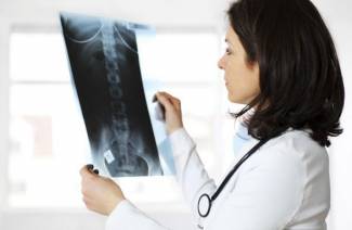 Spondylarthrose de la colonne lombaire