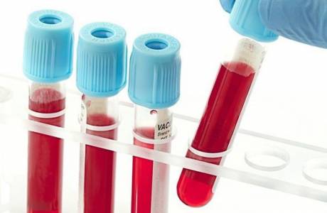 Ferritin