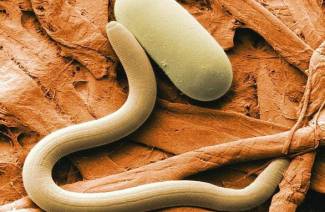 Trichinella gyvenimo ciklas