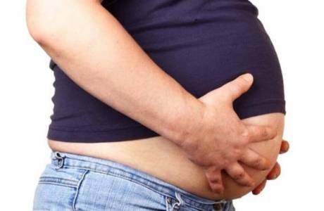 Ascites Ascites