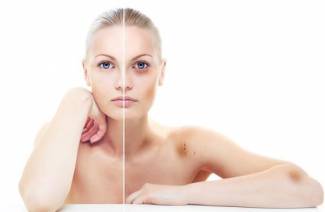 Trombositopeni nedir?