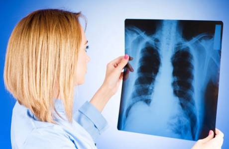 Métastases pulmonaires