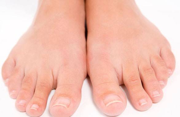 Åtgärd mot nagelsvamp Nomidol
