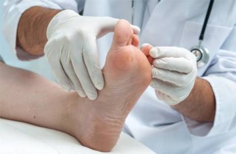 Quale medico tratta il fungo dell'unghia