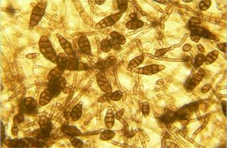Μύκητας Alternaria alternata